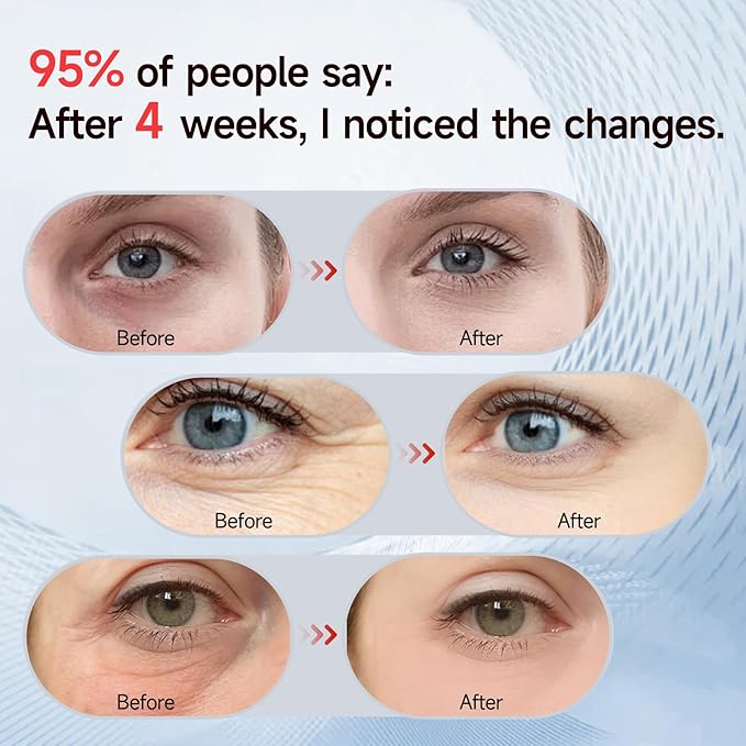 Under-Eye Red Light Therapy Device, Led 3D Microcurrent Eye Massage Glasses with 4 Modes, 3 Levels Red Light Eye Massage Mask for Relieve Eye Bags, Dark Circles, Wrinkles, Fine Lines