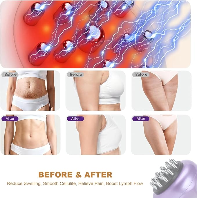 4-in-1 Lymphatic Drainage Massager - Anti Cellulite Massage Tool with Heating/Vibration/Red Light/Microcurrent,Body Sculpting Machine for Legs/Belly/Back/Hips/Reduce Stretch Marks & Cellulite