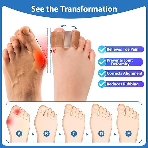 4-Pack Bunion Toe Separators for Overlapping Toes, 3-Point Support Gel Toe Spacers with 2 Fabric Lining Loops for Toe Protectors, Bunion Corrector for Women Men Big Toe (4 Pack, S)