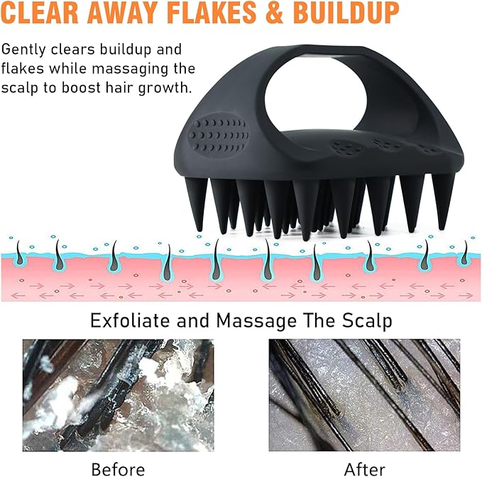 Scalp Massager Shampoo Brush, Scalp Scrubber for Dandruff & Build Up, Scalp Massager Hair Growth - 100% Silicone, Plastic Free