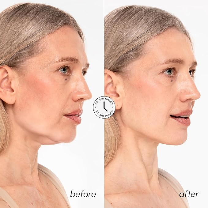 MAREE V Line Lifting Mask with 24K Gold – Deep Collagen Face Mask for Women – Jawline Shaper Mask with Retinol & Hyaluronic Acid – Neck Tightening & Firming – Double Chin Strap for Face Lift