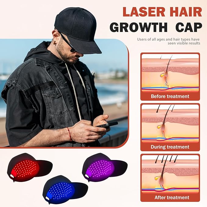LLLT Laser Hair Growth Cap for Thinning Hair, 650nm Red Light Therapy Hair Regrowth Treatment, Full Scalp Coverage, Hands-Free & Rechargeable Hair Loss Solution for Men & Women, Black