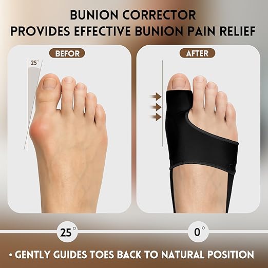 2 PCS Bunion Corrector for Women & Men - Big Toe Straightener with Splint & Pads,Breathable & Comfortable Big Toe Alignment Splint,Bunion Pain Relief Socks for Day/Night Support