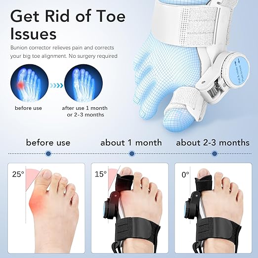 Bunion Corrector for Women Men: Big Toe Straightener Bunion Fix with Adjustable Knob-Orthopedic Bunions Splint Brace Toe Alignment Correction for Hallux Valgus Pain Relief Day/Night 1PCS (Black)