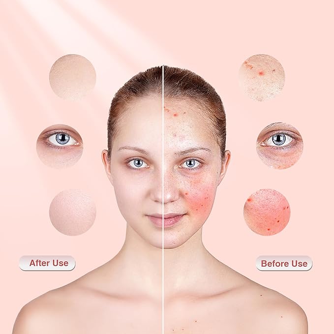 Red Light Therapy for Face, 4 Modes Portable Red Light Therapy for Face, 3000mAh Rechargeable Remote, 850nm Infrared & Red Light Masks, 280 LEDs, Timing Function, at Home & Travel