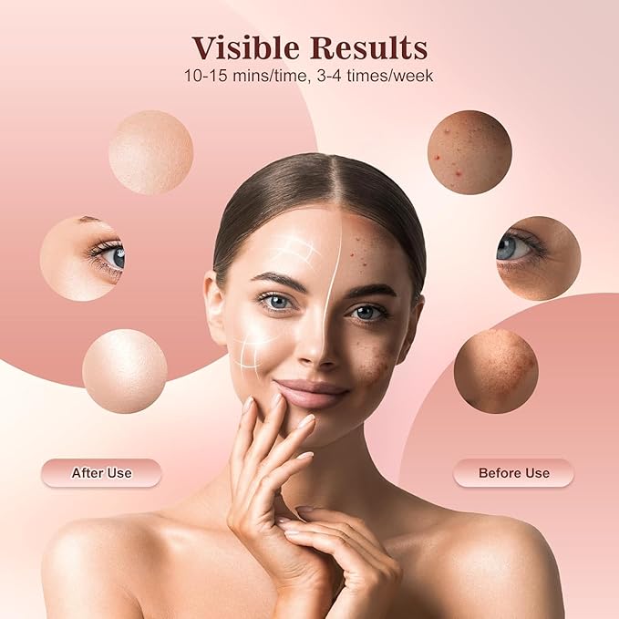INTEO Red Light Therapy for Face, 3 Modes Portable Led Face Mask Light Therapy with Remote, Near-infrared 850 Red Light Mask with Timing Function, Led Light Therapy At Home 180 LED Beads
