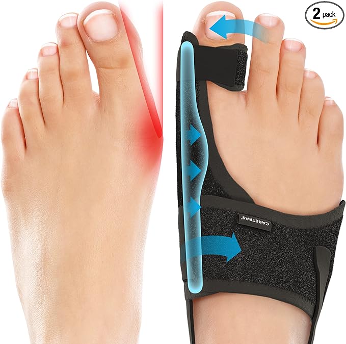 Caretras 2-Pack Bunion Corrector for Women & Men, Orthopedic Bunion Splint for Hallux Valgus Pain Relief, Big Toe Separator, Adjustable Day/Night Support, Comfortable Hammer Toe Straightener