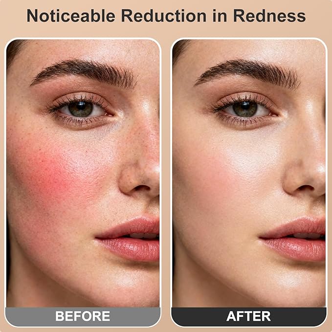 Red Light Therapy for Face and Body, Dual 660nm & 850nm Near Infrared Red Light Therapy Panel with Adjustable Stand and Timer, 3 Modes and 6 Brightness Levels,Ideal Gift for Family & Friends (white)