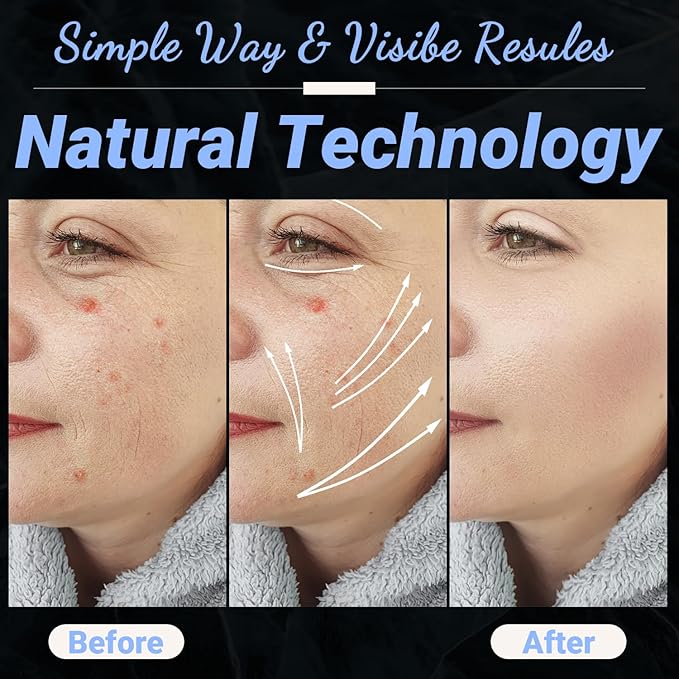 High Frequency Facial Wand - UUPAS Portable Handheld 4 in 1 Blue High Frequency Skin Facial Machine with 4 Pcs Different Blue Tubes for Home Use Face Device
