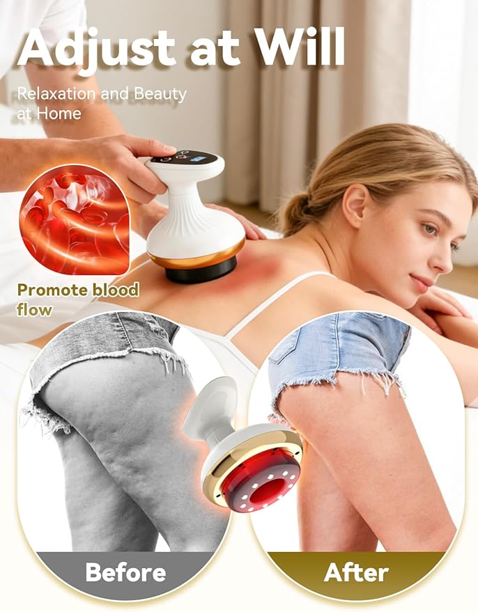 Cellulite Remover, Firmer, More Toned Skin, Deep Massage, Natural Skin Firmness, Deep Massage with Heat, Rechargeable Helps Reduce Stretch Marks & Cellulite for Legs, Arms & Belly (Standard with Oil)