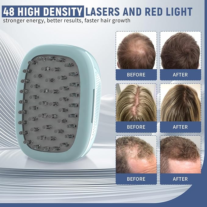 Laser Therapy Hair Growth Comb, Home Use Red Light Device, Rechargeable, Laser Hair Growth Treatment for Men and Women