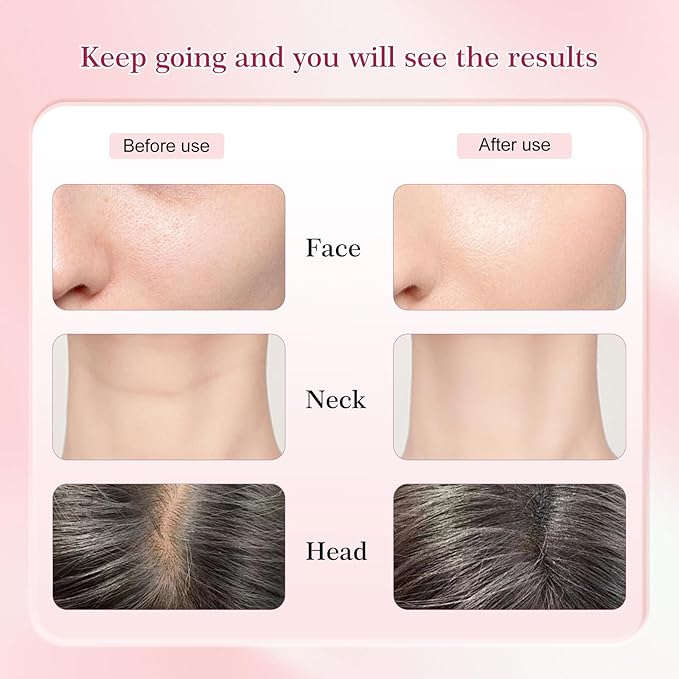 Red-Light-Therapy-for-Face and Neck-Eye-Head Massager,7 Colors Skin Rejuvenation Lifting Facial Massager for Toning,Glow Boost，Wrinkle for Birthday,Christmas,Mothers Day,Valentines Day Gifts(Green)