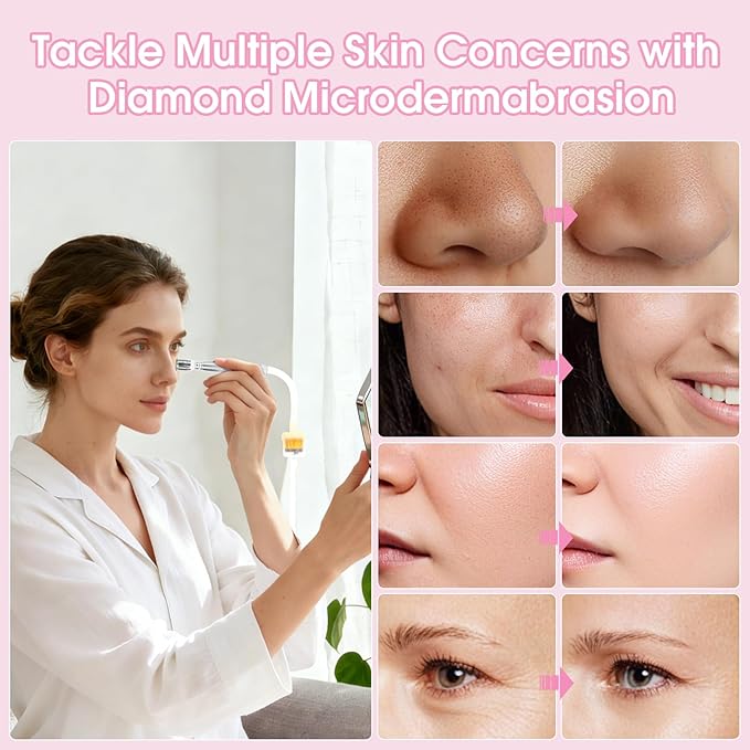 Pro Cordless Microdermabrasion Machine, Beauty Star Portable Facial Pore Vacuum Tool for Blackhead Removal, Glowing Skin, 3 Diamond Tips & 9-Setting Suction, Home and Salon Use