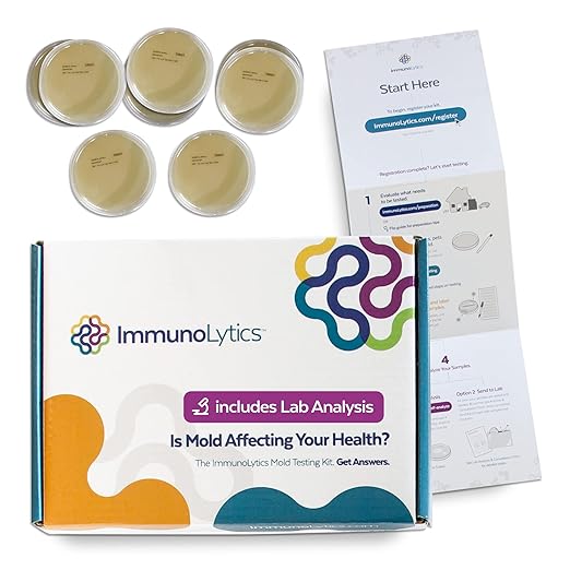 DIY Mold Test Kit for Home (8 Rooms/Plates) Includes Professional Lab Analysis, Easy-to-Use Mold Testing Kit, Individual Room Screening Package