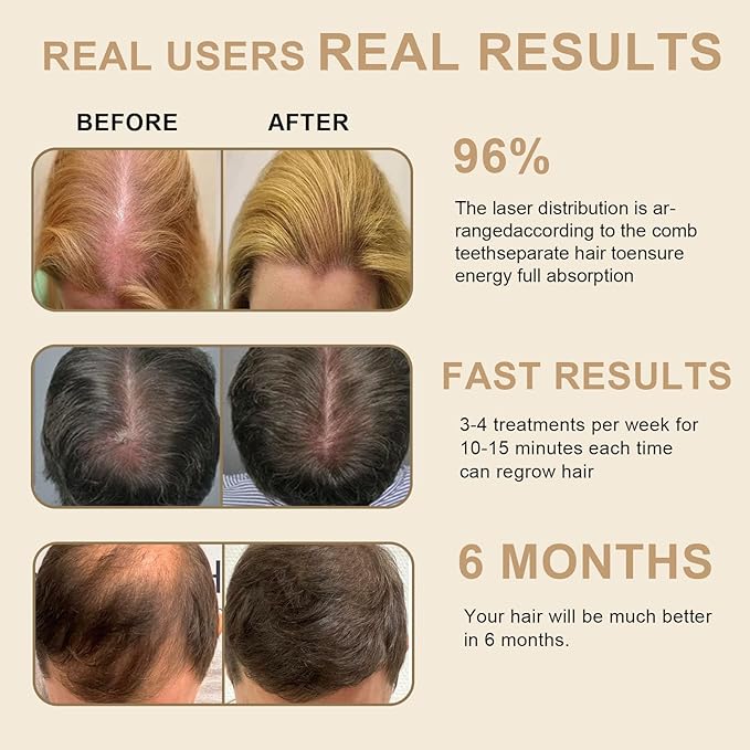 Laser Hair Growth Comb for Men & Women, FDA Cleared Red Light Therapy Device for Thinning Hair, Scalp Massager for Fuller, Stronger Hair, Black