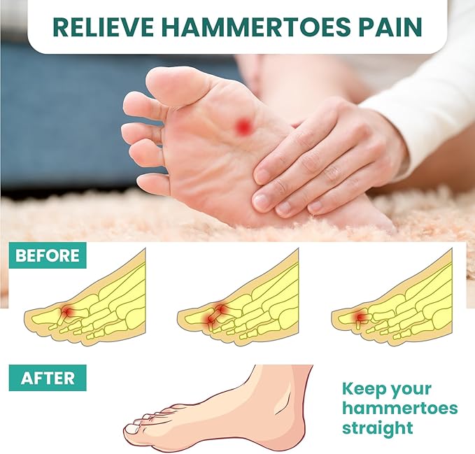 Welnove Hammer Toe Crests Straightener 4 Pcs Gel Toe Support Pads Cushion Relief for Overlapping-Curled-Hammer-Claw Toes, 3 Loop Design, Beige