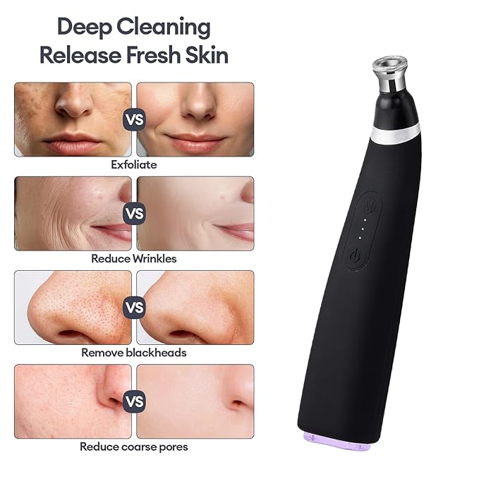IeBilif Diamond Microdermabrasion Machine, 3 Modes Diamond Microdermabrasion Dermabrasion Machine for Blackhead Removal, Portable Microdermabrasion Tool with 8 Diamond Tips