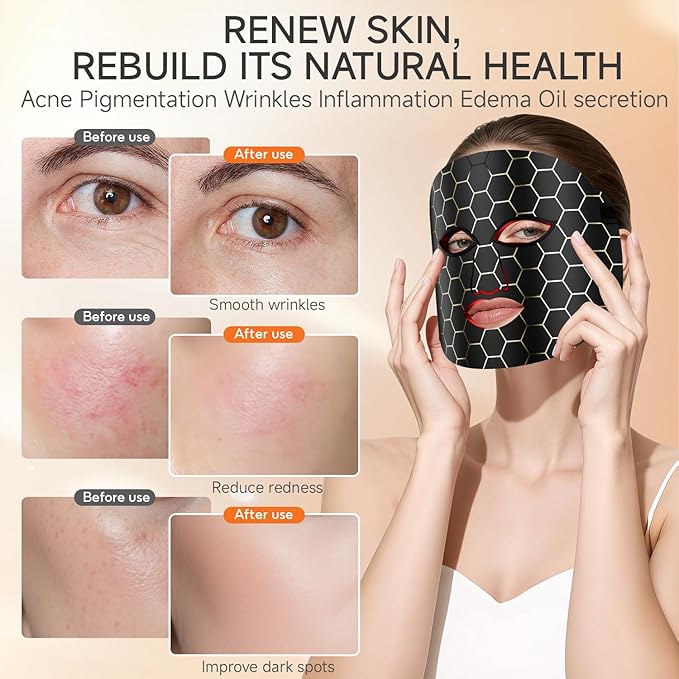 Red Light Therapy Mask for Face,LED Light Therapy mask FM-01, Portable Red Light Therapy Mask, (Black)