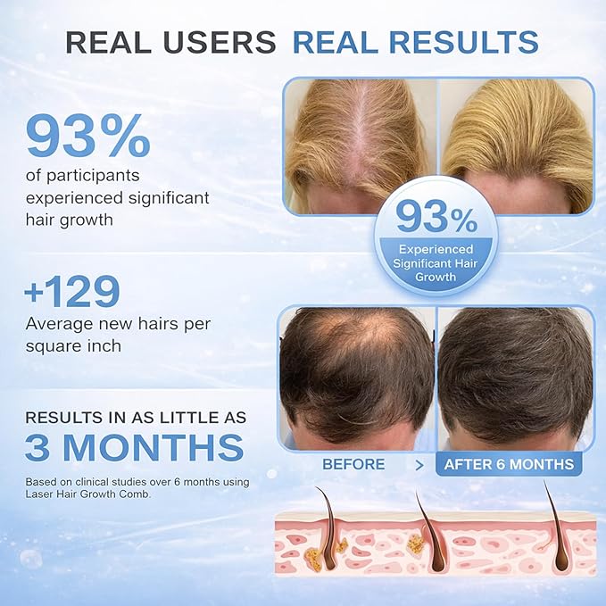 Obiredk ㅤLaser Hair Growth Comb - Lasers & LEDs for Hair Regrowth - FDA Cleared Rechargeable Scalp Massager for Men Women - Effective for Thinning Crown, Receding Hairline - Black