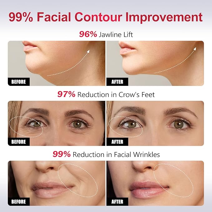 2-in-1 Red Light Microcurrent Facial Device | Enhances Lifting & Firming Capabilities | Reduces Wrinkles and Puffiness | Smart Photon Micro-Current Device, Model:EP-300