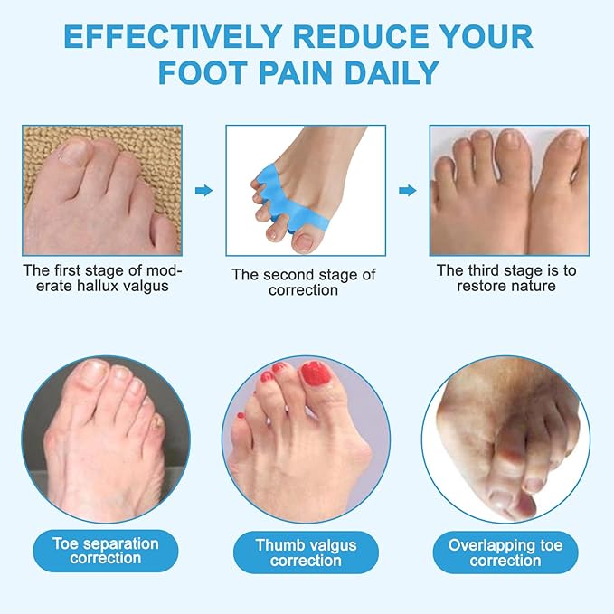 Toe Separators/Toe Spacers for Men and Women - Bunion Corrector & Hammer Toe Straightener for Overlapping Toes, Silicone Gel Pain Relief for Pedicure & Daily Care (Blue)