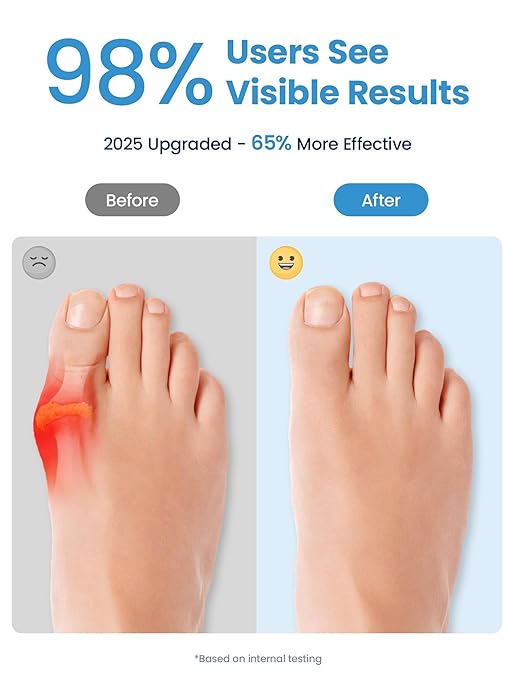 Bunion Corrector, Toe Separators for Women Men Big Toe, Toe Spacers, Bunion Correction, Breathable(2PCS)