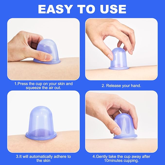 Silicone Cups for Cupping Therapy Included 4 Pcs Cups and 1 Pc Bag,Cupping Kit for Massage Therapy,Cellulite Reduction Vacuum Cup(Blue)
