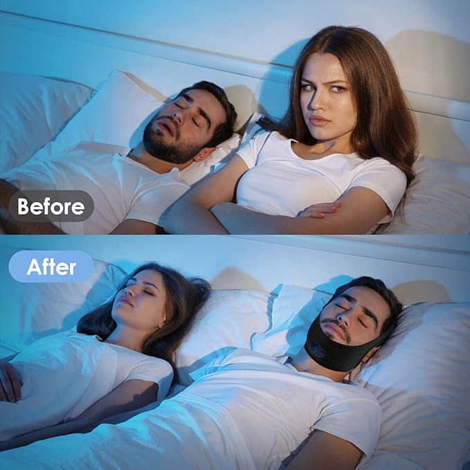 Chin Strap for Sleeping,Anti Snoring Chin Strap for CPAP Users,V-Line Lifting Mask,Adjustable and Breathable Chin Strap-Keep Mouth Closed for Effectively Reduce Snoring (Black-White)