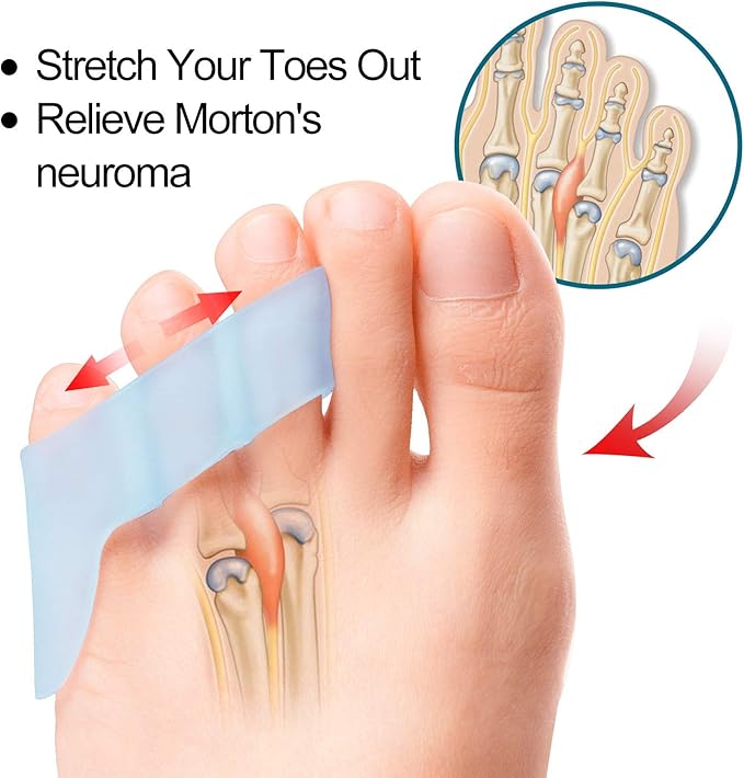 Povihome 10 Pack Pinky Toe Separator and Protectors for Overlapping Toe, Curled Pinky Toes - Spacers for Morton's Neuroma Pain Relief