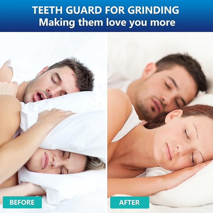 Mouth Guard for Sleeping, 8 PCS Mouthguard for Grinding & Clenching Teeth at Night, Night Guards for Grinding of Teeth, Dental Bite & Boil Guard with 12 Cleaning Tablets