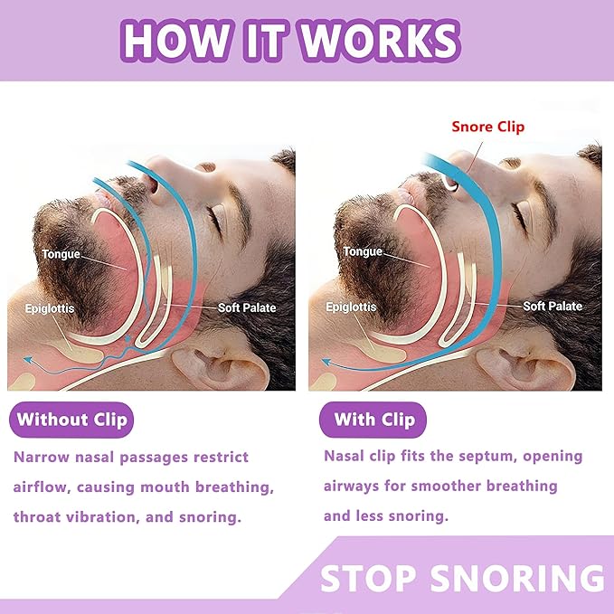 Anti Snoring Devices (8 Pack), Adjustable Silicone Snoring Solution, Anti Snoring Nose Clip, Effectively Relieve Snoring, Stop Snoring for Men and Women, Clear