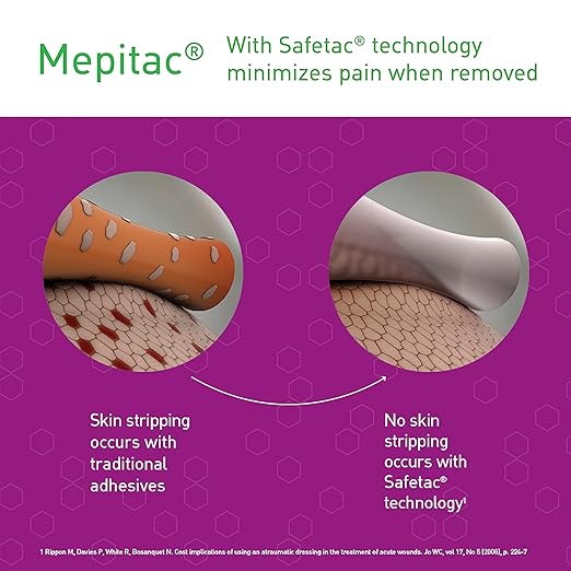 Mepitac 298300 Soft Silicone Tape, 2 cm x 3 /0.8 in x 3.3 yd