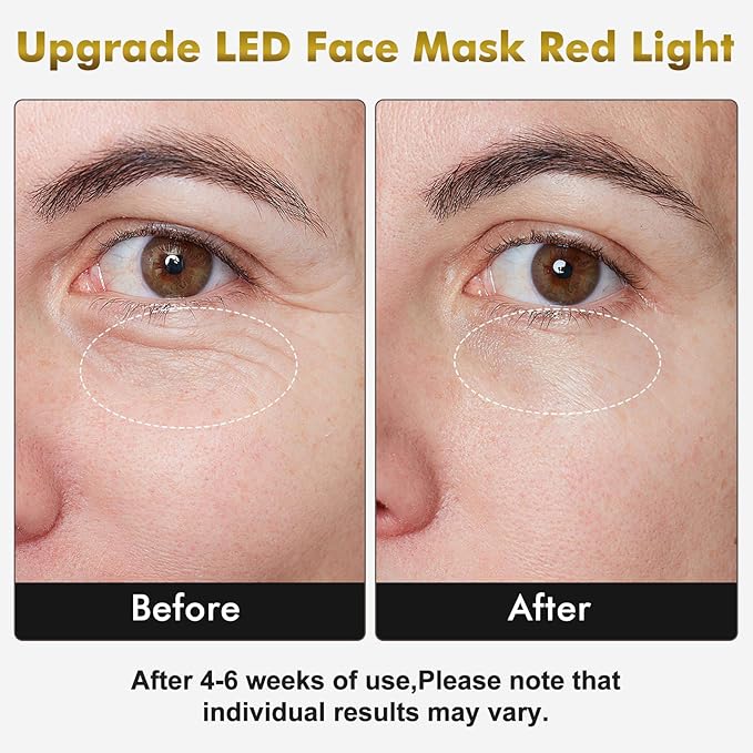 Red Light Therapy for Face & Neck Mask, Led Face Mask Light Therapy with 7 Colors, 309 LED Beads Silicone Facial Skin Care Device for Home SPA Beauty Salon