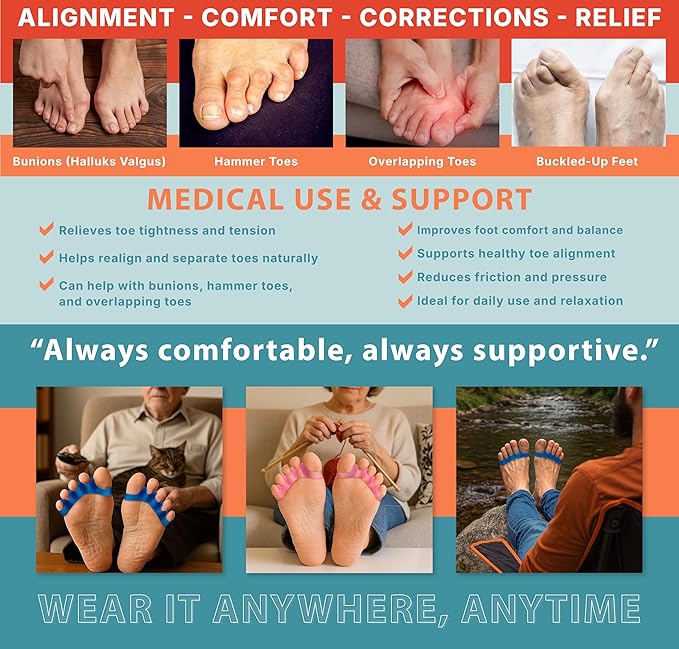 TEGA Toe Separators & Spacers for Men and Women - Silicone Toe Straightener for Bunion Correction, Plantar Fasciitis & Hammer Toe Relief - Restore Natural Foot Shape (Large)