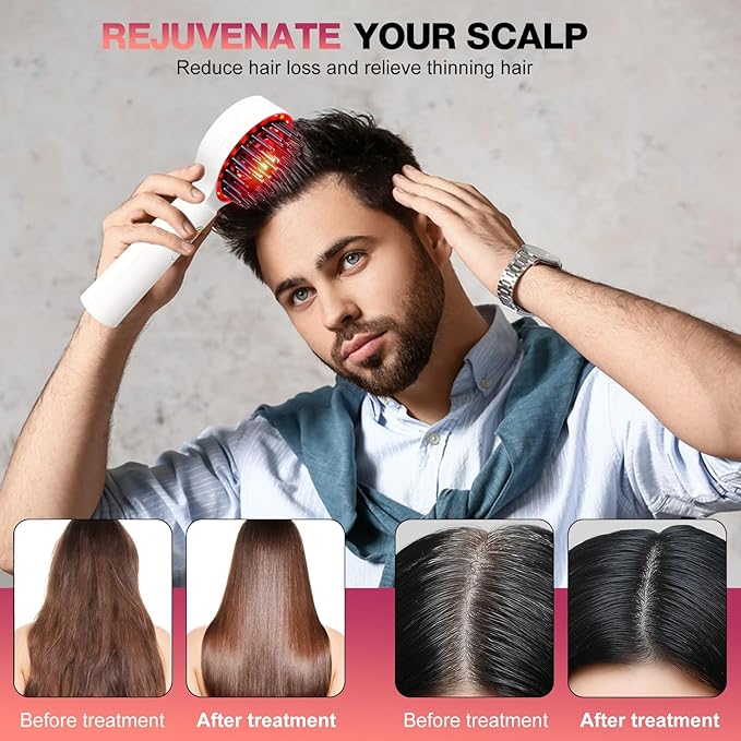 3 in 1 Scalp Massager Hair - 360° Hair Oil Applicator Electric Scalp Massager IPX7 Waterproof for Home & Travel (White)