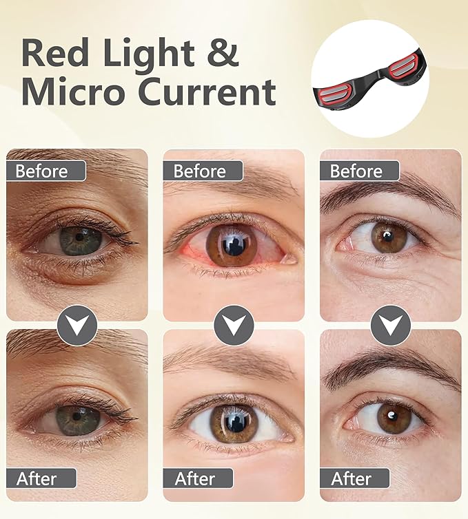 Under-Eye Red Light Therapy Glasses, Rechargeable Therapy Device Microcurrent Eye Massager, Eyes Bag Remover for Dark Circles, Eye Bags & Wrinkles