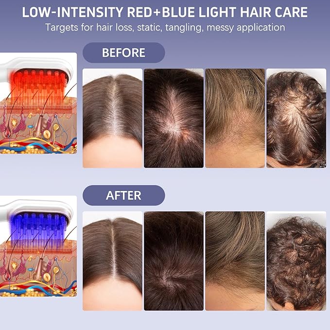 Karrong Hair Scalp Massager Comb Scalp Oil Applicator, Waterproof Red Blue Light Therapy Hair Care Brush, Automatic Vibrating Head Massage Comb for Men & Women