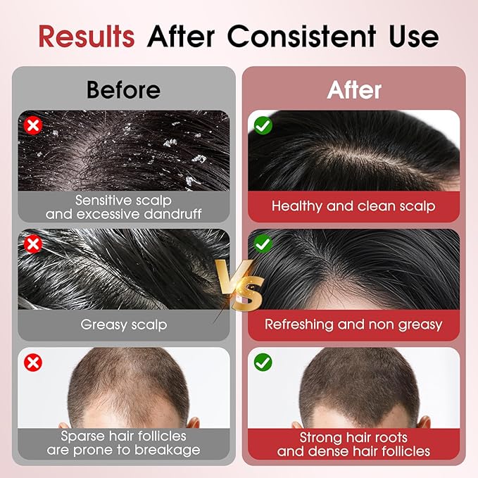 Upgrade Laser Therapy Hair Growth Comb, Hair Oil Applicator and Red Light Hair Brush,Electric Scalp Massager Hair Growth with IPX7 Waterproof