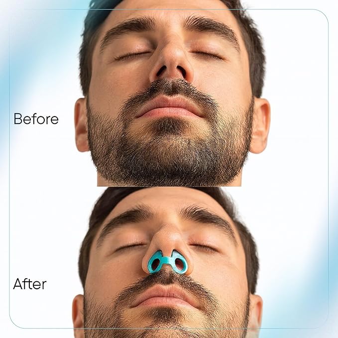 Nasal Dilators for Sleeping – Nose Opener & Nose Breather (4 Sizes S/M/L/XL) Internal Anti Snoring Nose Vents – Soft Silicone Nasal Expander for Better Airflow & Night Breathing