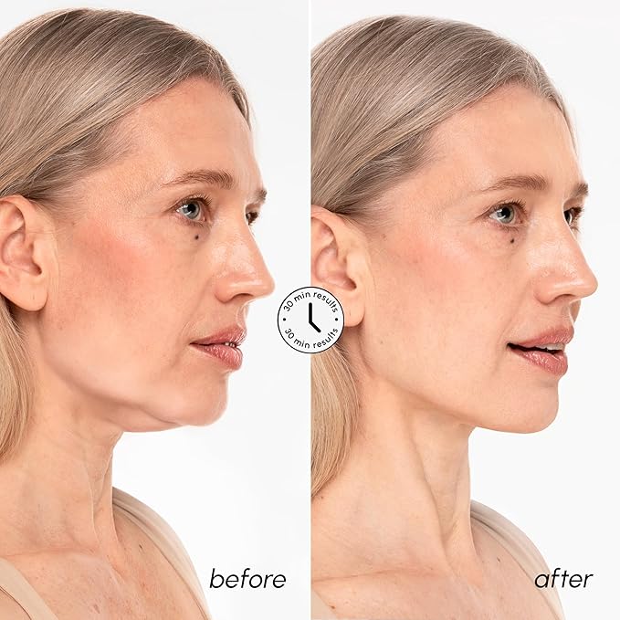 MAREE V Line Lifting Mask with 24K Gold – Deep Collagen Face Mask for Women – Jawline Shaper Mask with Retinol & Hyaluronic Acid – Neck Tightening & Firming – Double Chin Strap for Face Lift