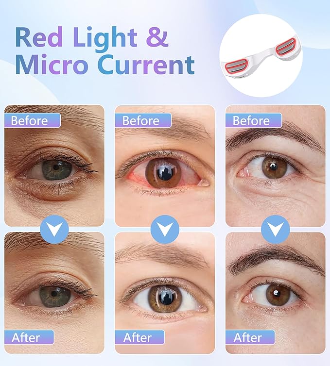 Under-Eye Red Light Therapy Glasses, Rechargeable Therapy Device Microcurrent Eye Massager, Botanique Paris Eyes Bag Remover for Dark Circles, Eye Bags & Wrinkles (White)
