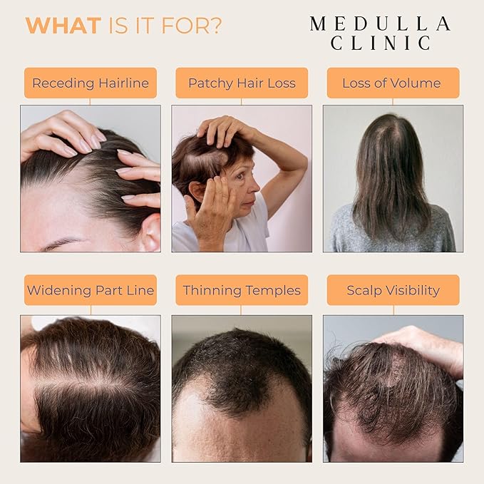 Hair Growth Serum Roll-On – 5% Rosemary, 3% Protein & 2% Caffeine – Batana Oil & Biotin for Scalp & Hair Thickening – Targeted Non-Greasy Treatment – 1 fl oz (30 ml)