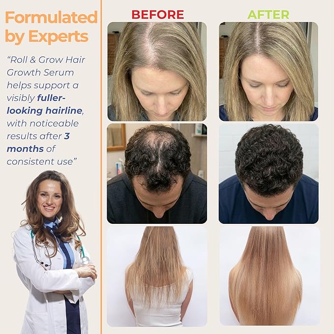 Hair Growth Serum Roll-On – 5% Rosemary, 3% Protein & 2% Caffeine – Batana Oil & Biotin for Scalp & Hair Thickening – Targeted Non-Greasy Treatment – 1 fl oz (30 ml)