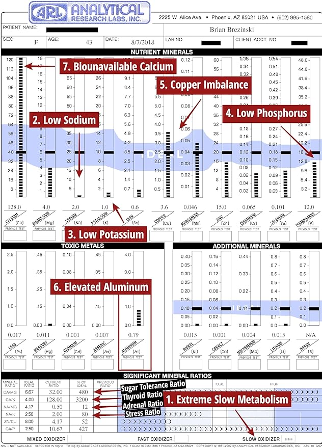 MineralBalance™ Hair Tissue Mineral Analysis (HTMA)—At-Home Test Kit for Fatigue, Anxiety, Sleep & Digestive Issues—Tests 20 Minerals & Heavy Metals Including Magnesium & Zinc—Full Lab Report Included