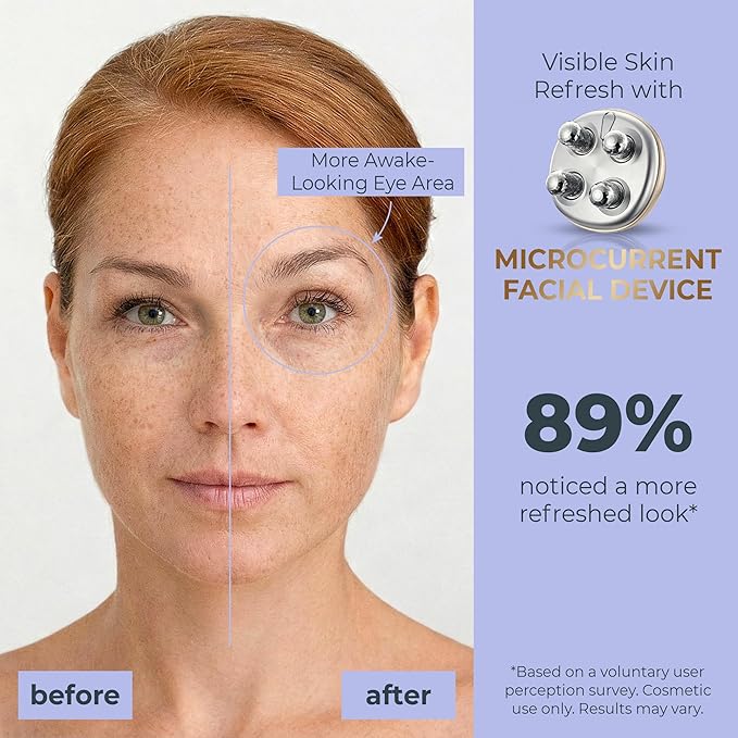 Microcurrent Facial Device, Face Massager Tool, Eye and Neck Massager, Face Roller, Beauty Tools for Relaxing Facial Massage and Skin Care Routine, Gold Color
