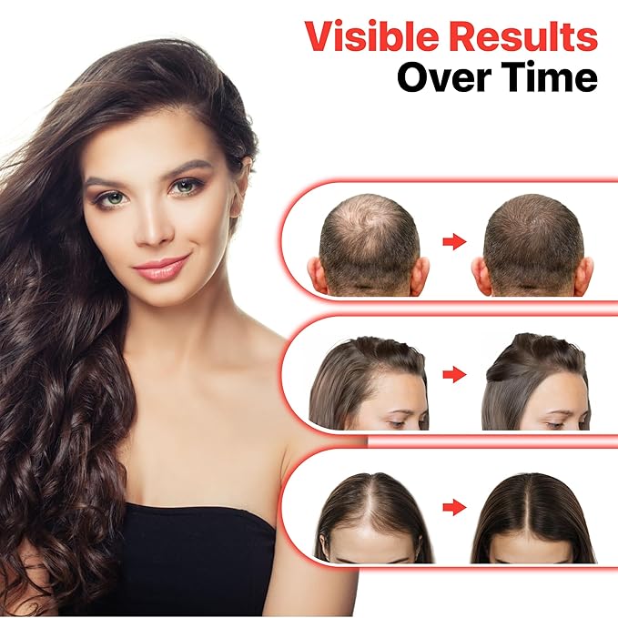 Red Light Therapy Cap for Hair Growth – Infrared Light Therapy Treatment 176 LEDs, 660 nm Red + 850 nm Infrared for Hair Loss Regrowth - Safe Scalp Boosting Care at Home
