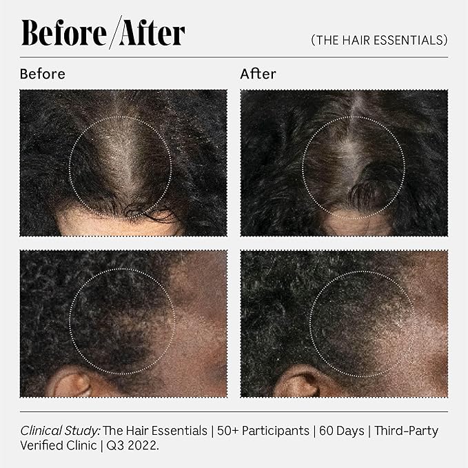 Nécessaire The Scalp Serum. 5% Capixyl™ + 1% Hyaluronic Acid For Fuller, Thicker, Healthier Hair. Fragrance-Free. Approved by the National Eczema Association. 2 fl oz