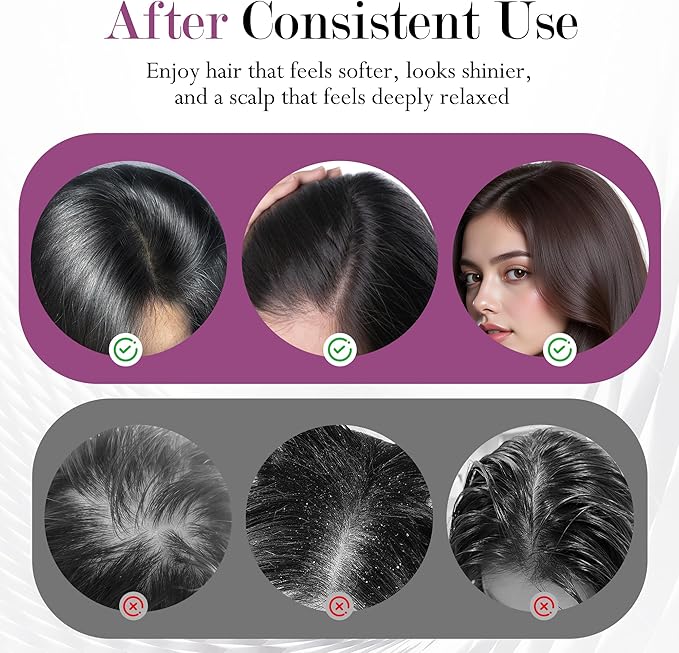 3-in-1 Rechargeable Scalp Massager Hair Growth Oil Applicator, Gentle Scratching & Kneading, IPX7 Waterproof, Electric Head Massage Tool for Home Spa, Portable Scalp Brush for All Hair Types