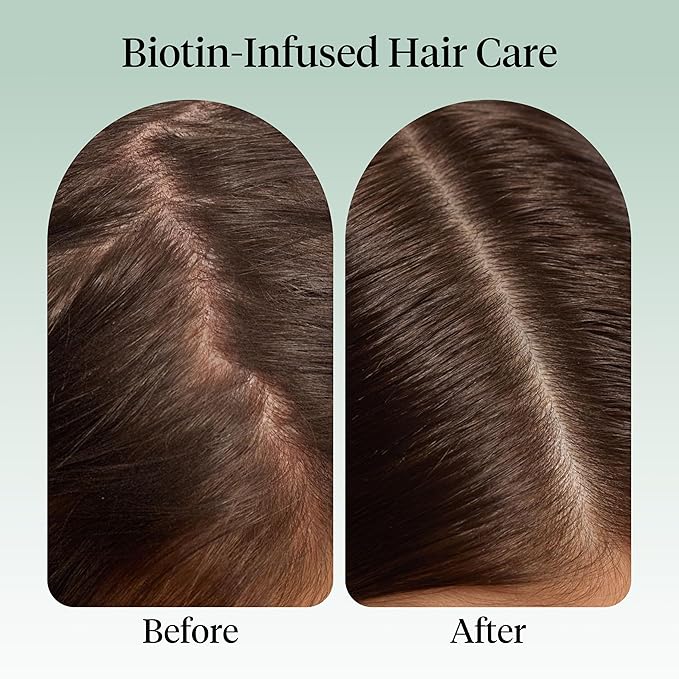 Kitsch Rosemary Oil for Hair Growth – Hair Oil with Biotin, Castor & Jojoba – Pre-Wash Scalp oil for Hair Care – Lavender Scent – 10mL | Ideal Gifts for Women