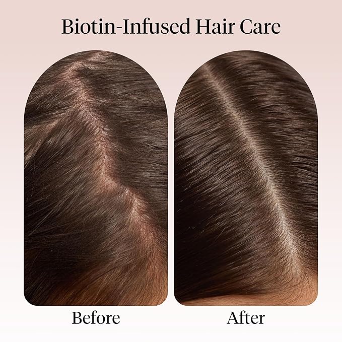 Kitsch Rosemary Oil for Hair Growth – Pre-Wash Hair Oil with Castor, Biotin, Jojoba – Hair Care, Adds Shine, Strengthens Roots, Scalp Treatment | Ideal Gifts for Women – Lavender Scent, 60mL
